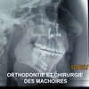 orthodontie et chirurgie des machoires