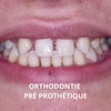 orthodontie et chirurgie des machoires
