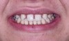sourire en début de traitement