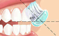 TECHNIQUE DE BROSSAGE DES DENTS