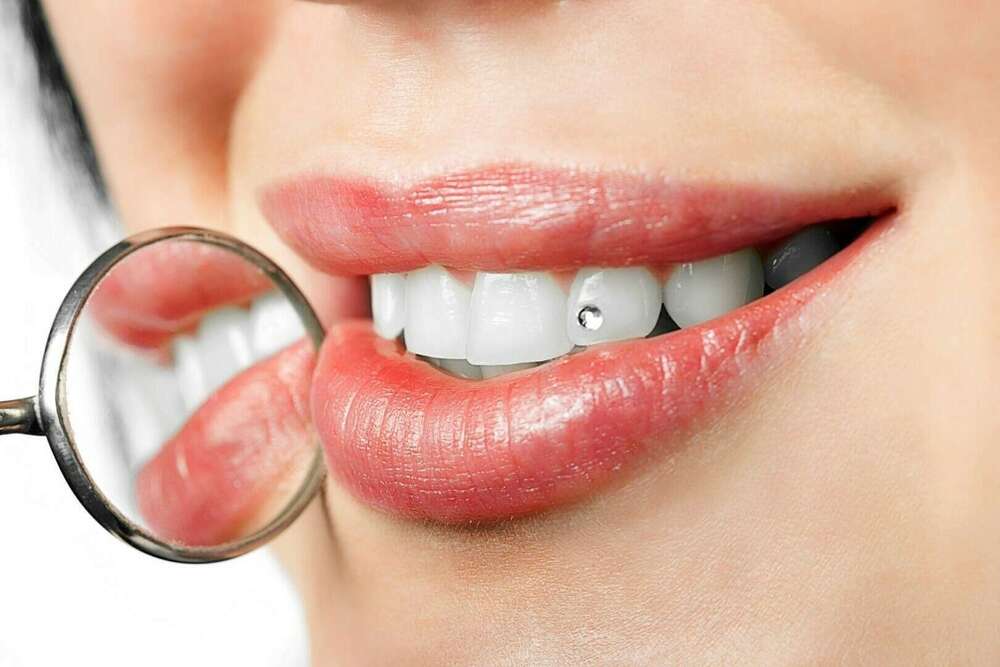 LES DANGERS DU PIERCING BUCCAL