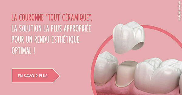 La couronne "tout céramique"