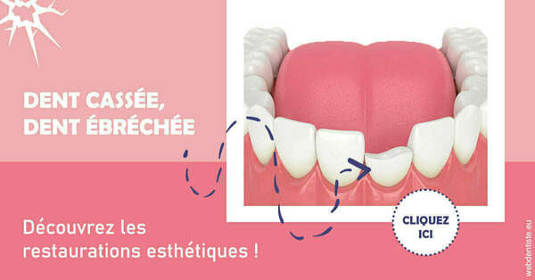 Dent cassée ébréchée