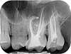 radiographie dentaire
