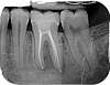 radiographie dents