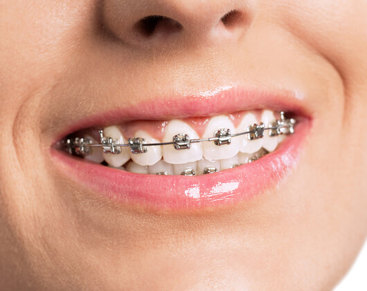 Logo Cabinet d'orthodontie du Graziella BRUNOT