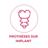 Implant dentaire et implantologie