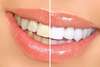Eclaircissement