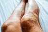 piqure jambe punaise de lit