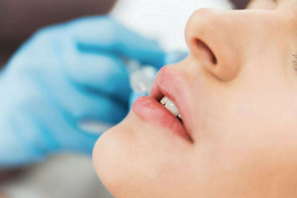 Acide hyaluronique et soins bucco-dentaires