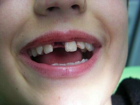 ESTHÉTIQUE ANTÉRIEURE ET CHIRURGIE GUIDÉE