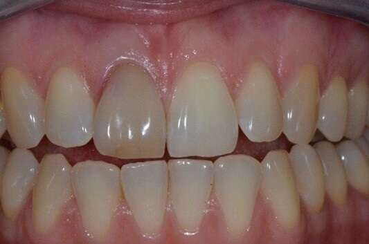 CAS CLINIQUE DU DOCTEUR MAXIME COLLANGETTES