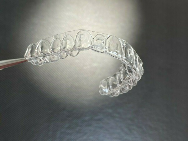 Traitement orthodontique "Made in Bayeux"