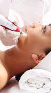 traitement d'acupuncture sur l'oreille avec des aiguilles fines