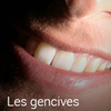Les gencives