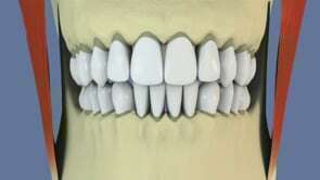 Le mouvement normal de l’articulation temporo-mandibulaire