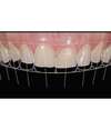 L'EQUIPEMENT : Digital Smile Design (DSD)