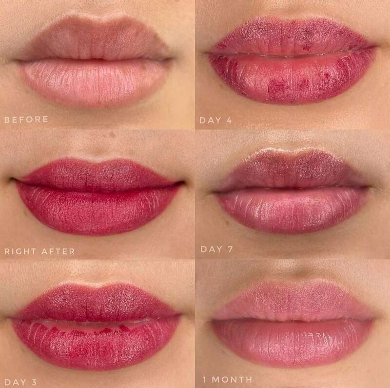 processus_de_cicatrisation_bouche