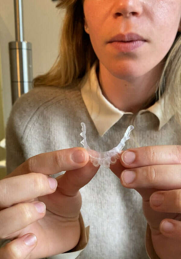 Les arcs anatomiques, "in-liners" système  orthodontique invisible le plus innovant