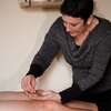 Acupuncture/Acupressure