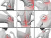 MDS thérapie , praticien en acupressure à Blois (41000)