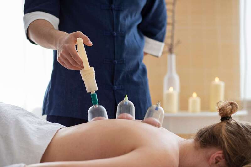 Ventouses-cupping thérapie