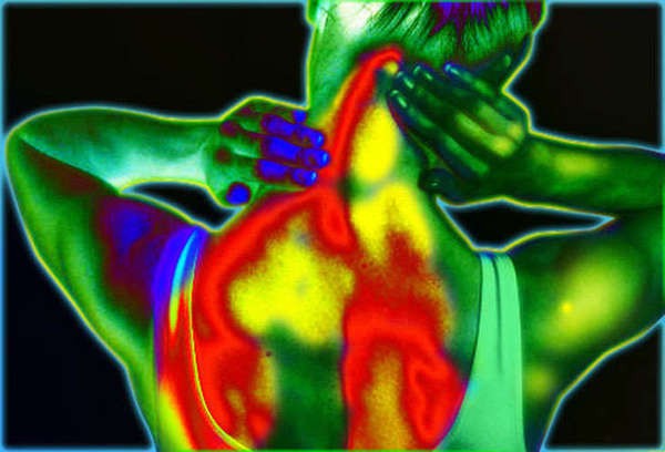 La Fibromyalgie, c'est l'aluminium, point final !