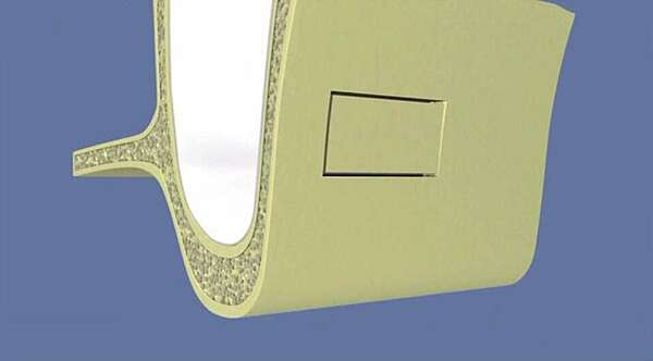 Comblement de sinus par abord latéral sans pose d’implant