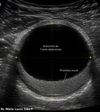 Femme enceinte consulte médecin pour suivi échographique vasculaire