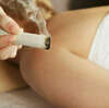 Moxibustion