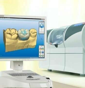 Prothèse dentaire toute céramique avec CEREC en 1 seul RDV