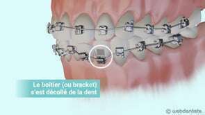 Les urgences orthodontiques