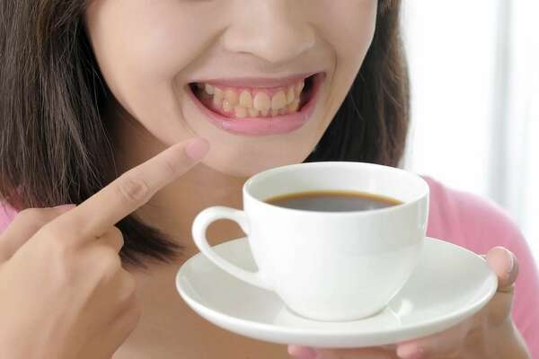 Les colorations dentaires