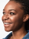 Appareil orthodontique multi-attaches sur le sourire d'une patiente