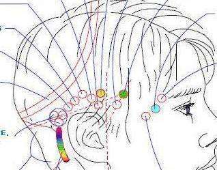 La finalité d' Access Bars
