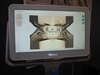 Modèle 3D des arcades en occlusion affiché à l'écran du scanner intra-oral