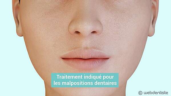 Traitement orthodontique - appareil autoligaturant en céramique