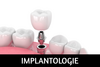 Implantologie