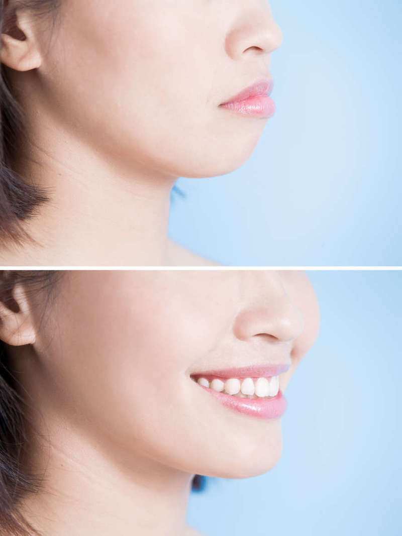 Chirurgie orthognathique à Villemomble