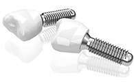 IMPLANTS DENTAIRES ZIRCONE NOUVELLE GENERATION