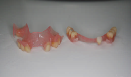 Posturodontie en quelques cas intéressants