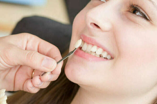 DENTISTE ESTHETIQUE NICE