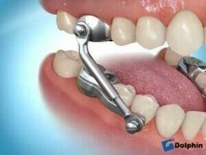 Activateur de  croissance par bielles