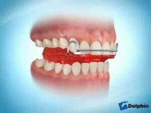 Activateur de  croissance par plaque