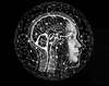 cerveau stylisé lumineux symbolisant protocoles de PNL