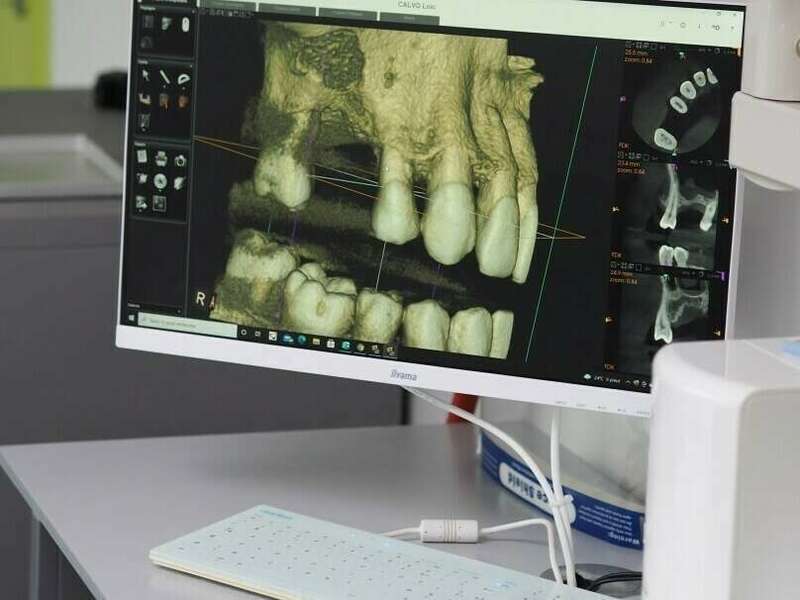 dozkbcgrnh_1634662461