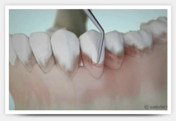 Traitement des gencives et chirurgies orales