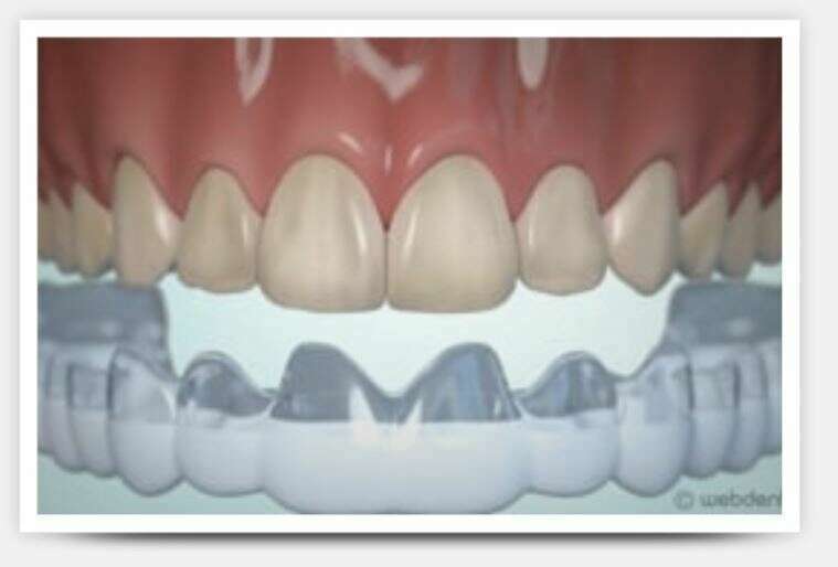 Dentisterie esthétique