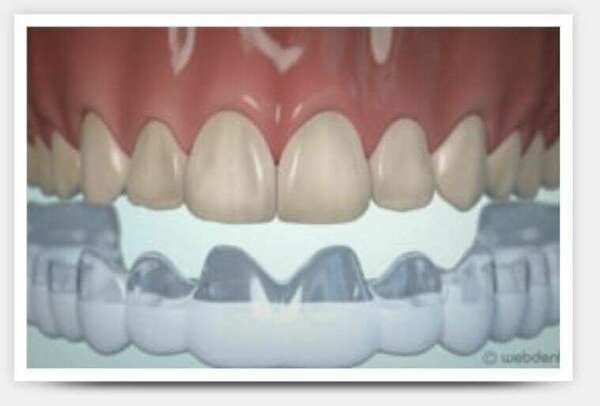 Dentisterie esthétique