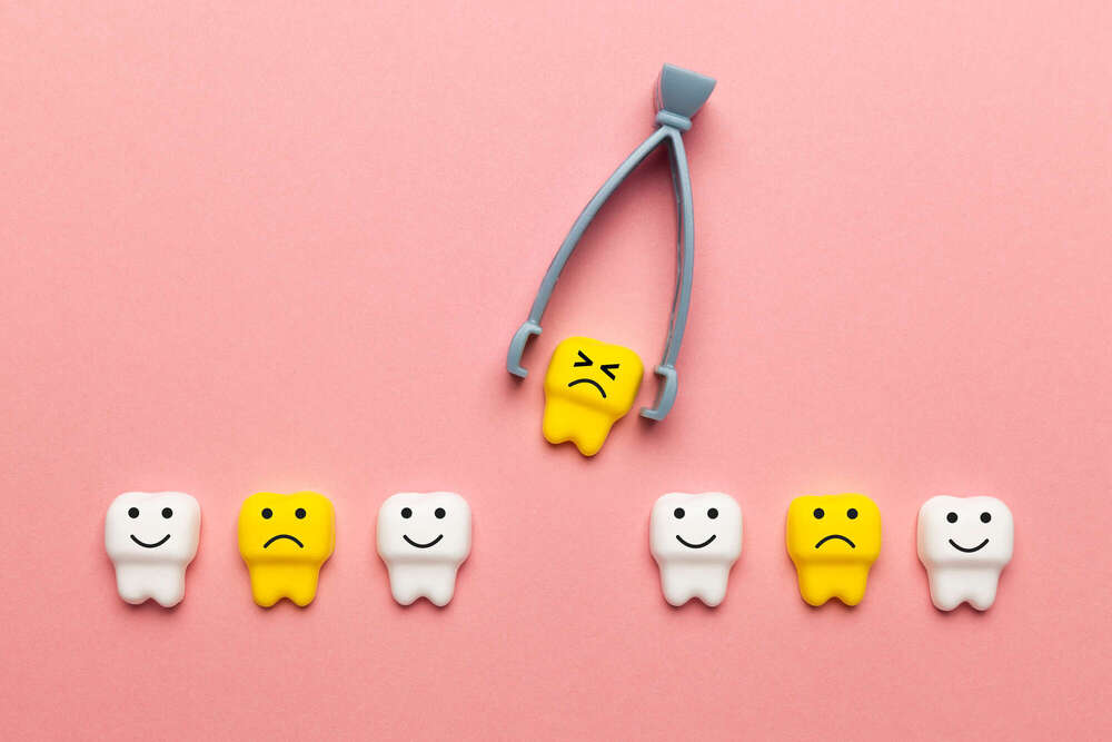 Extraction des dents de sagesse à Balma Sourire – Une intervention sûre et anticipée